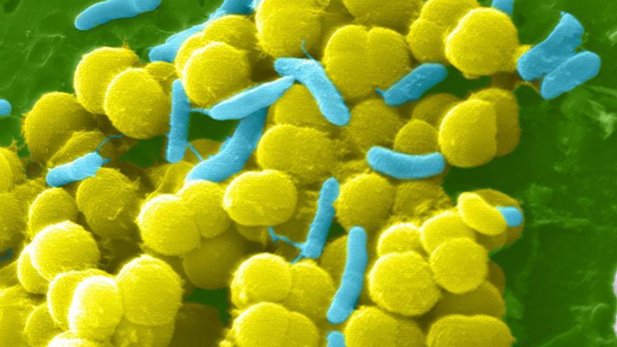 Sepsis: Micrografía electrónica de barrido a color de bacterias