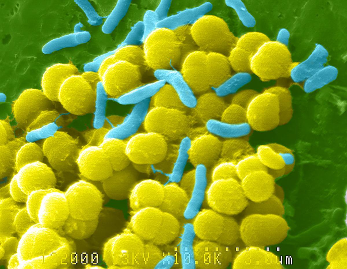 Sepsis: Micrografía electrónica de barrido a color de bacterias