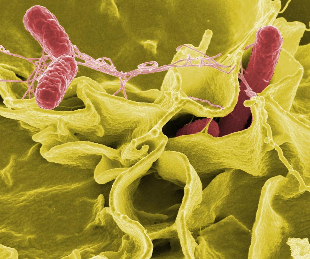 Salmonella Typhimurium (roja) invadiendo células humanas cultivadas