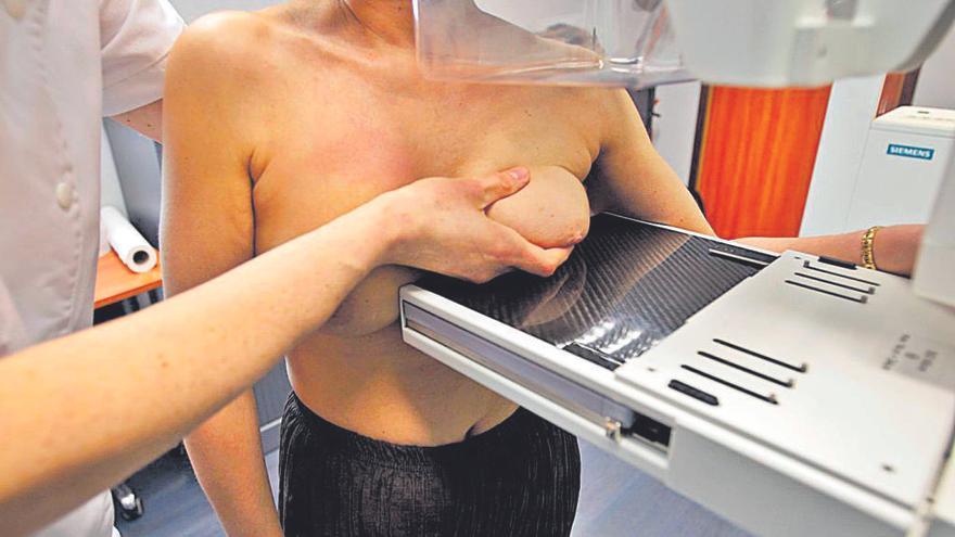 Imagen de archivo de una mujer haciÃ©ndose una mamografÃ­a para prevenir el cÃ¡ncer de mama.