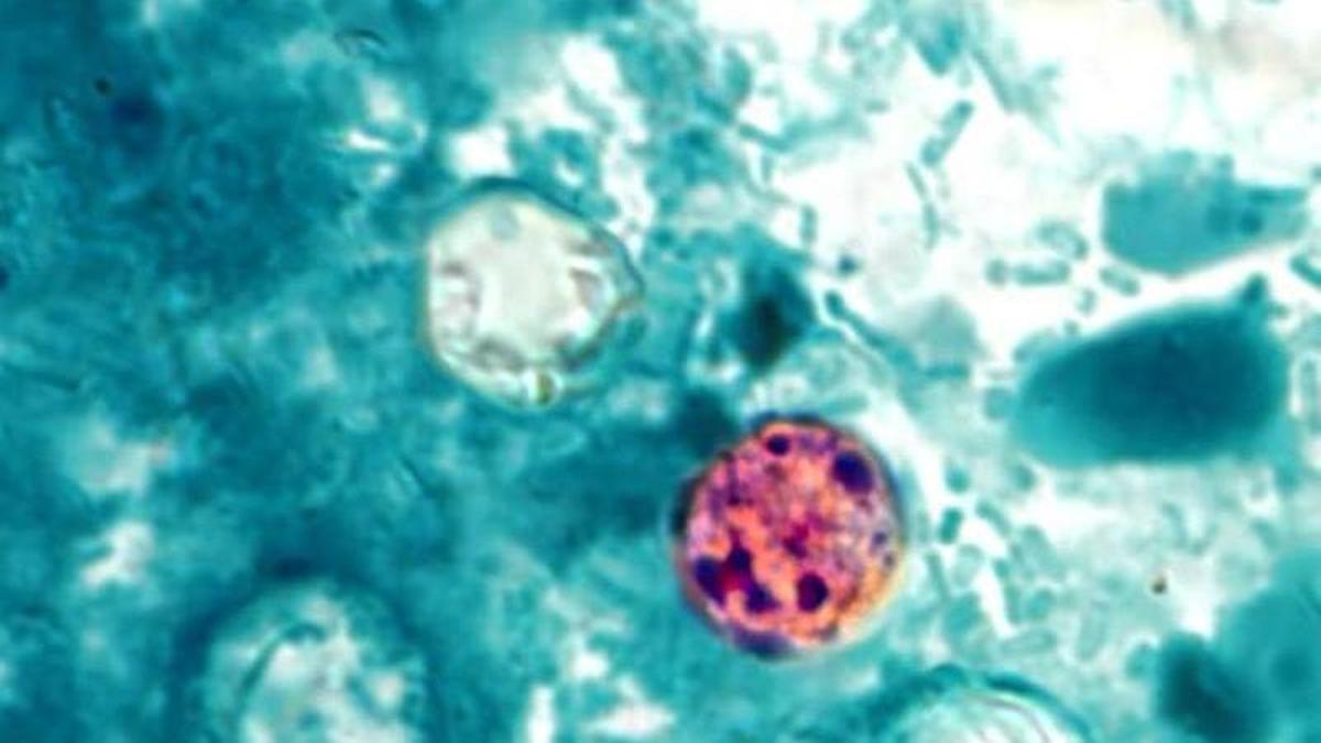 Ciclosporiasis, el parásito que está detrás del brote de diarrea explosiva en Estados Unidos