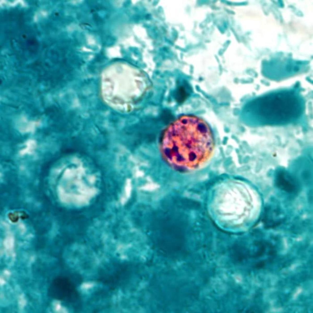 Ciclosporiasis, el parásito que está detrás del brote de diarrea explosiva en Estados Unidos