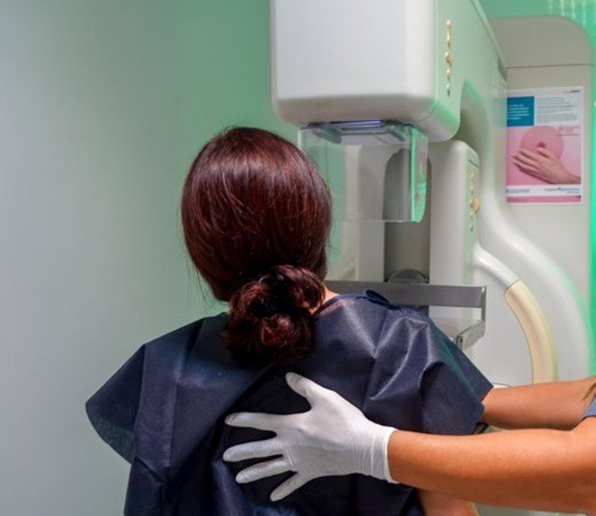 Imagen de recurso de mamografía.