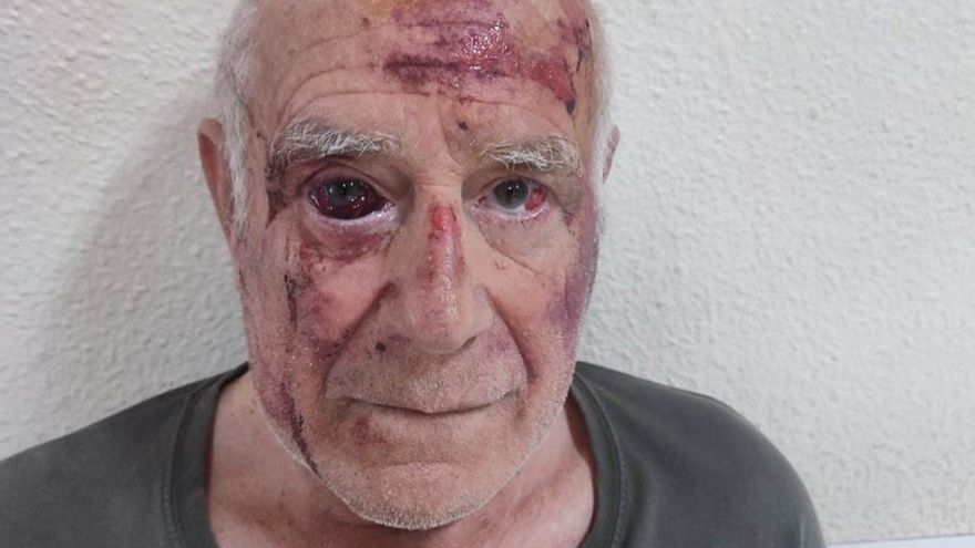 El sexagenario agredido en Torre Pacheco se desmarca de las &#039;cacerías&#039;: &quot;Yo la violencia no la quiero&quot;