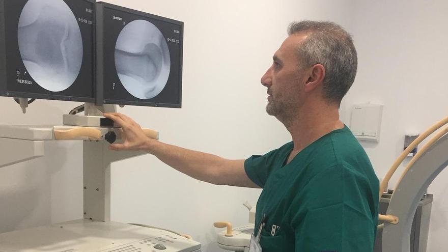 La medicina regenerativa se aplica ya con éxito en la artrosis de rodilla