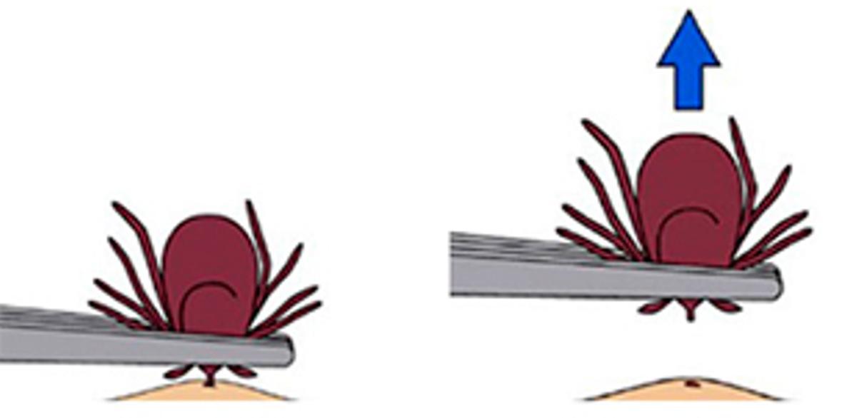 Procedimiento de extracción de una garrapata