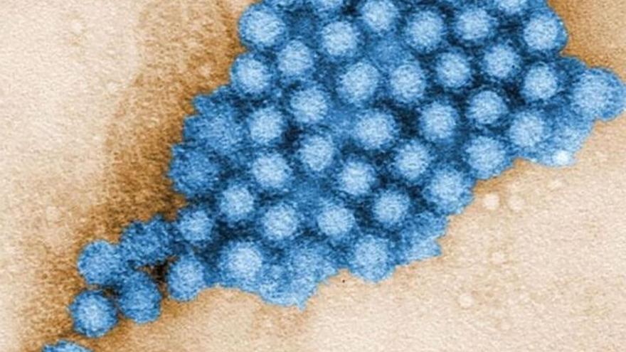 Qué es el contagioso norovirus que ha provocado un brote de 144 casos en Almería