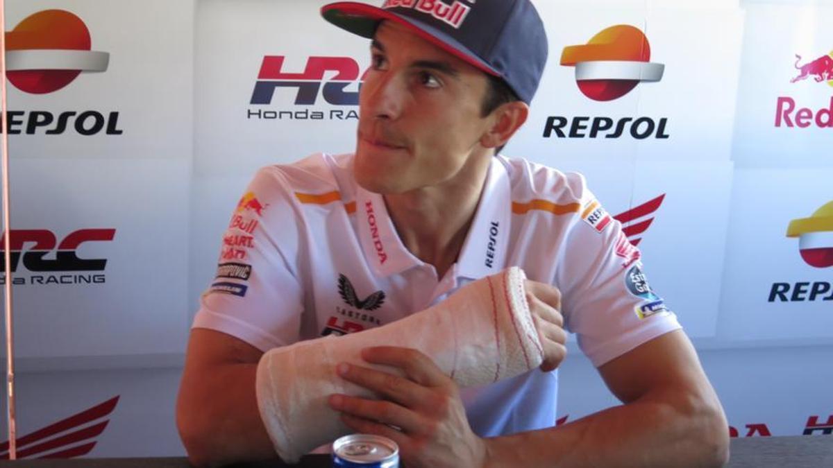Marc Márquez (Honda) se ha fracturado un dedo pulgar de la mano derecha.