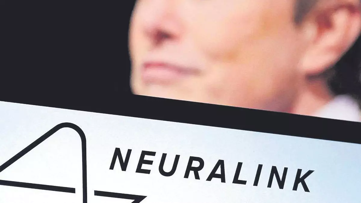 Nace un nuevo sector industrial: el cerebro