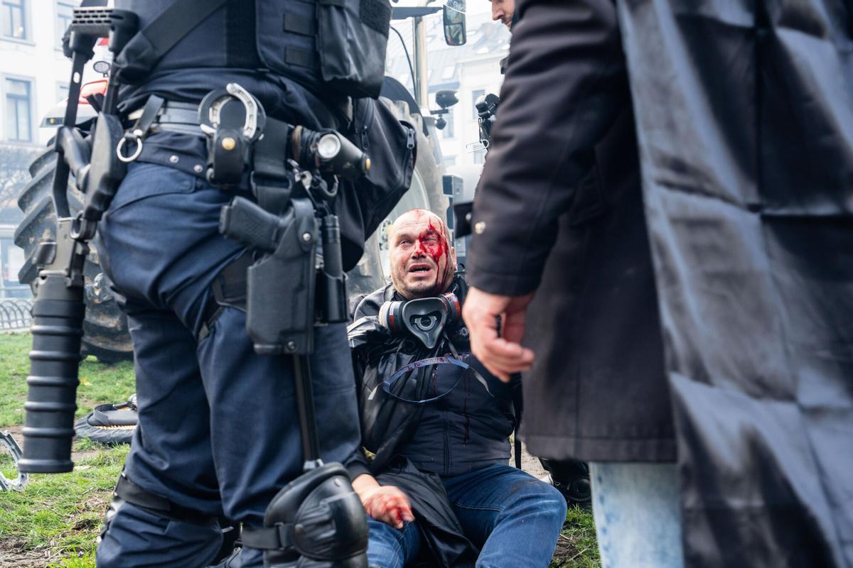 Un manifestante herido descansa sentado en un bordillo durante los enfrentamientos frente al Parlamento Europeo. 18 de diciembre de 2025, Bruselas.