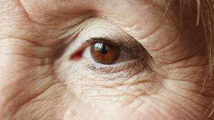 El principal factor de riesgo de la degenración macular es el envejecimiento.