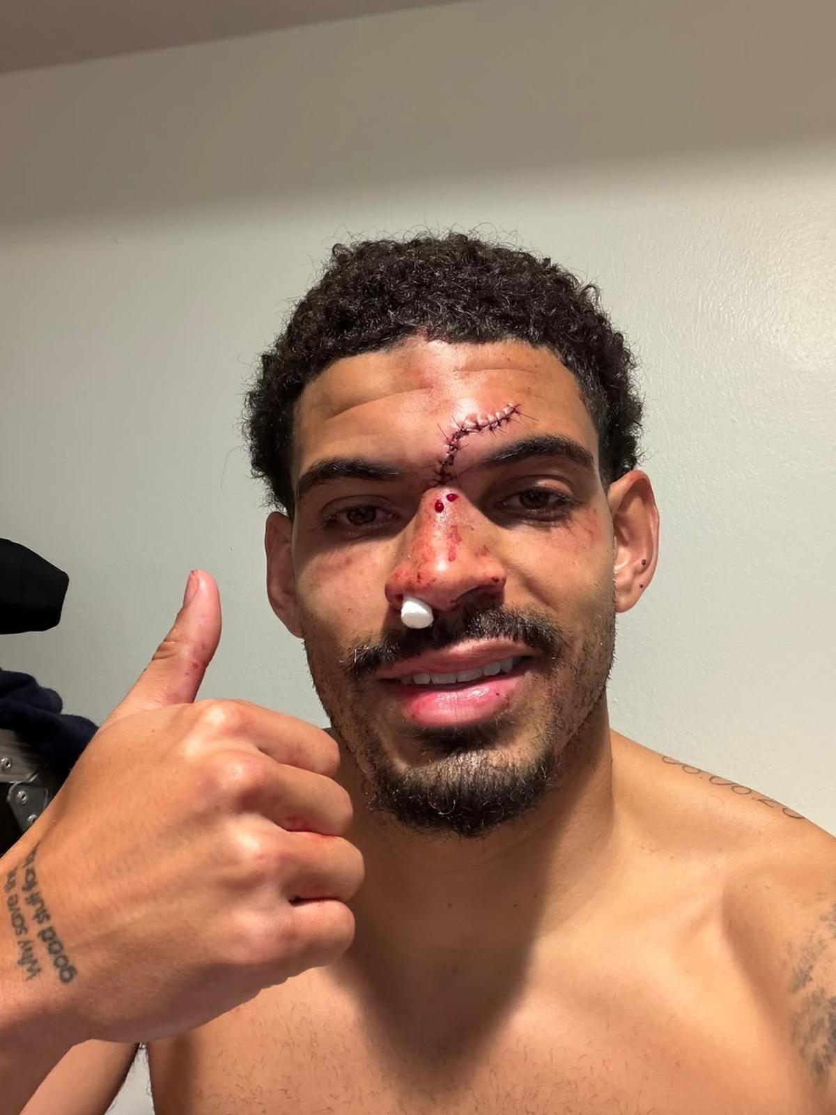 Morgan Gibbs-White tras el partido ante el Chelsea FC