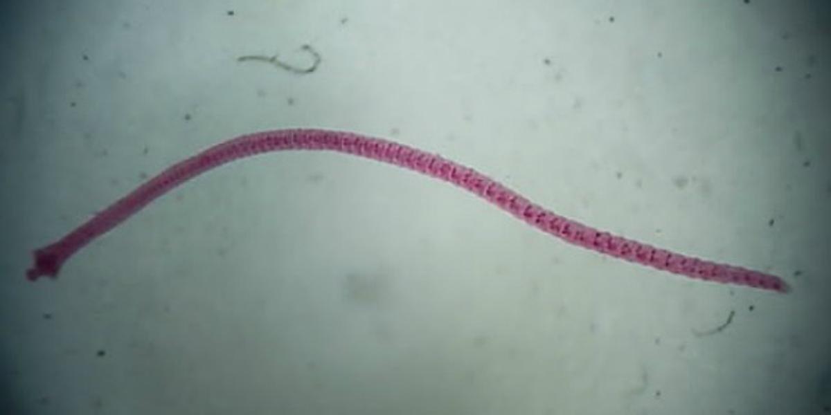 ’Hymenolepis nana’.