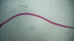 ’Hymenolepis nana’.