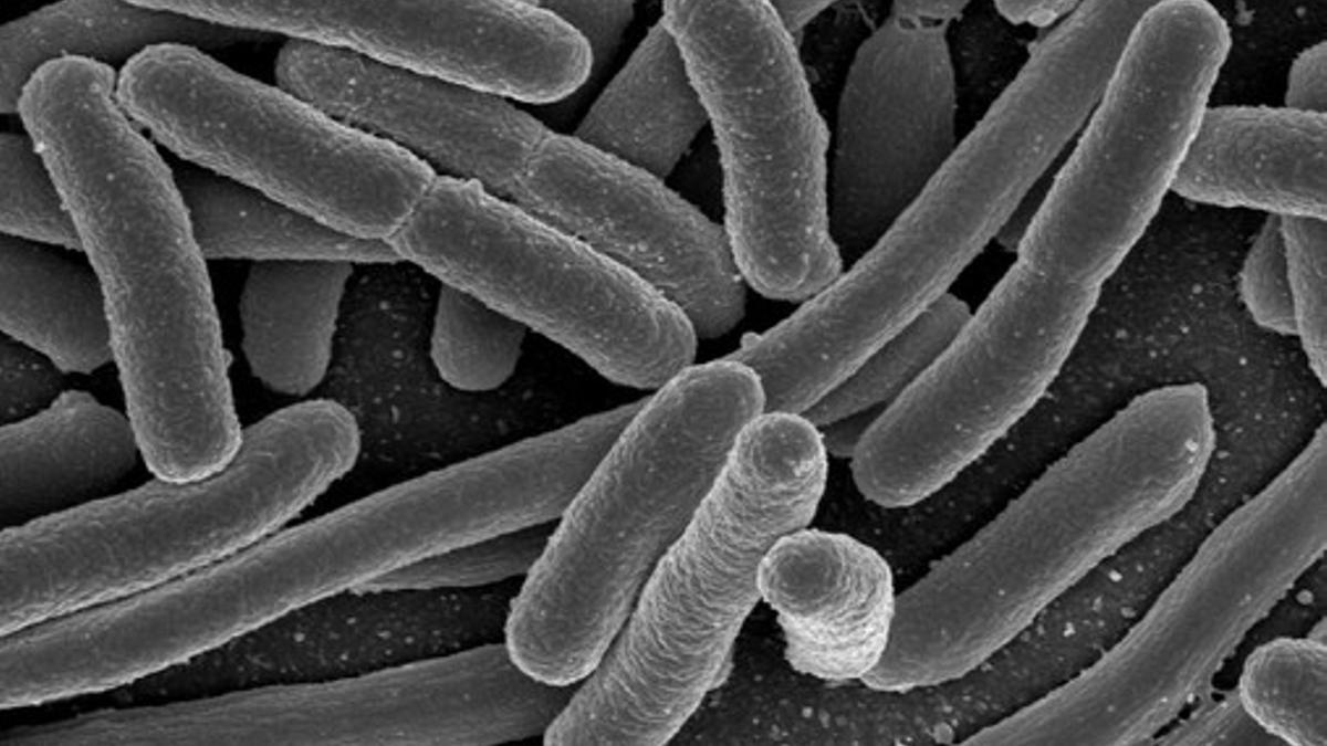 'Escherichia coli', una de las muchas especies de bacterias presentes en el intestino humano.