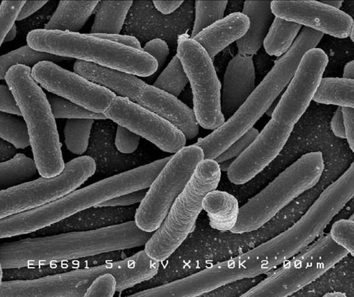 ’Escherichia coli’, una de les moltes espècies de bacteris presents en l’intestí humà. ’Escherichia coli’, una de les moltes espècies de bacteris presents en l’intestí humà.