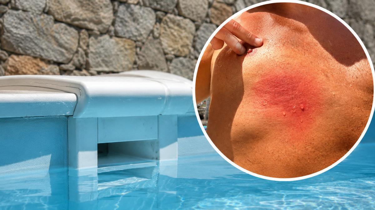 El filtre d'una piscina atrapa un banyista de 40 anys a Mogán: «Un infant no ho hauria  explicat»