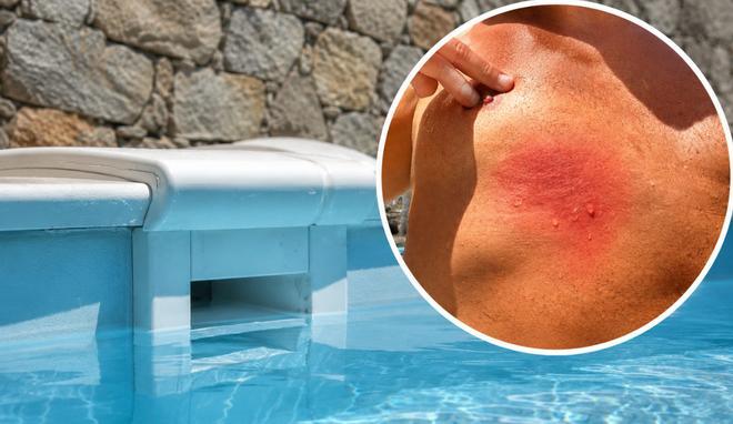El filtro de una piscina atrapa a un bañista de 40 años en Mogán: "Un niño no lo habría contado"