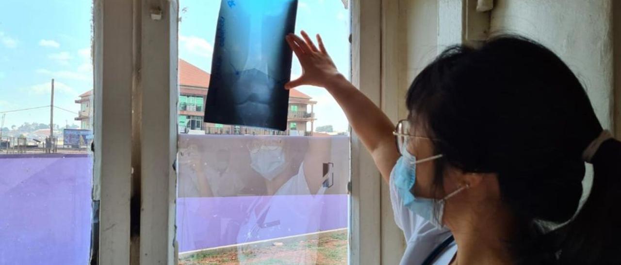 Carolina Ding observa una radiografía utilizando una ventana, en un hospital, durante su estancia como voluntaria en Uganda. | INFORMACIÓN