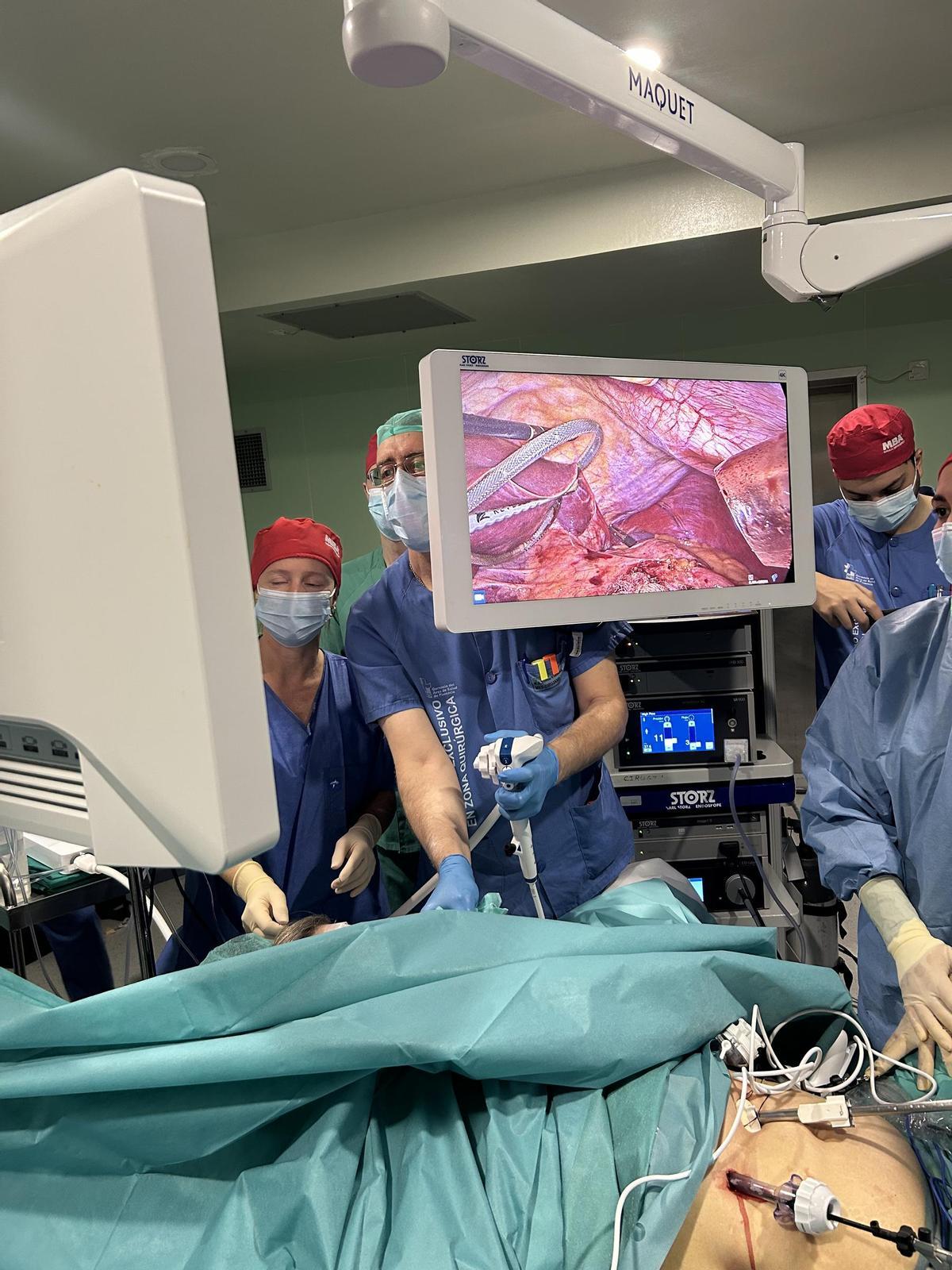 Los cirujanos del hospital de Plasencia estrenan una nueva técnica.
