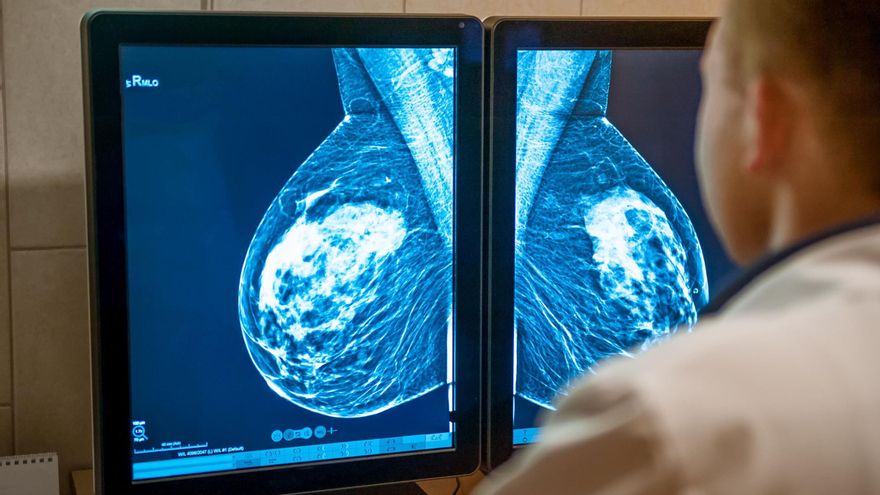 Los tipos de cáncer de mama metastásico más comunes y cómo afectan a las pacientes