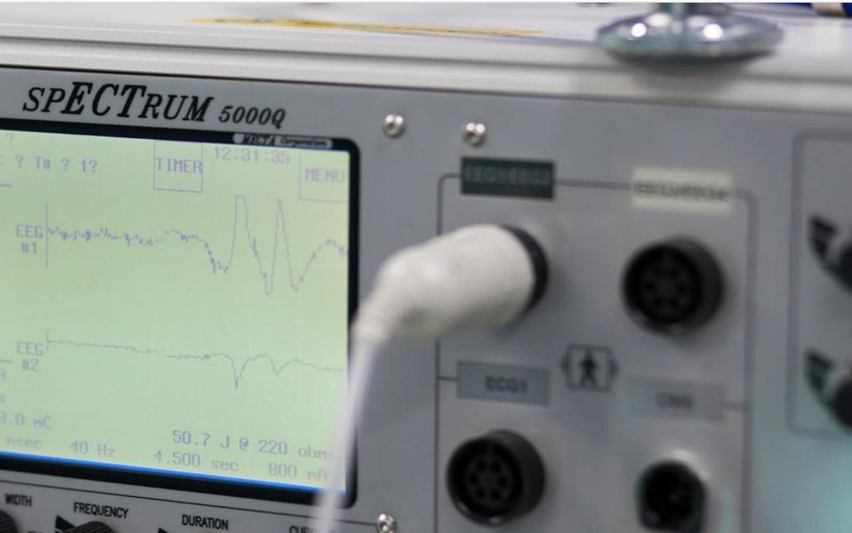 Imagen de parte del instrumental para monitoriar una sesión de TEC