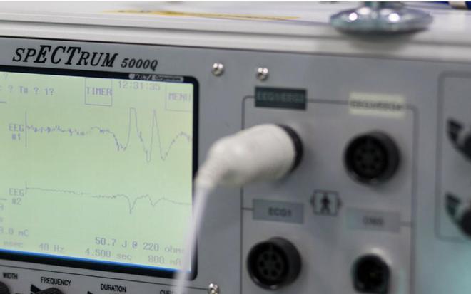 Imagen de parte del instrumental para monitoriar una sesión de TEC
