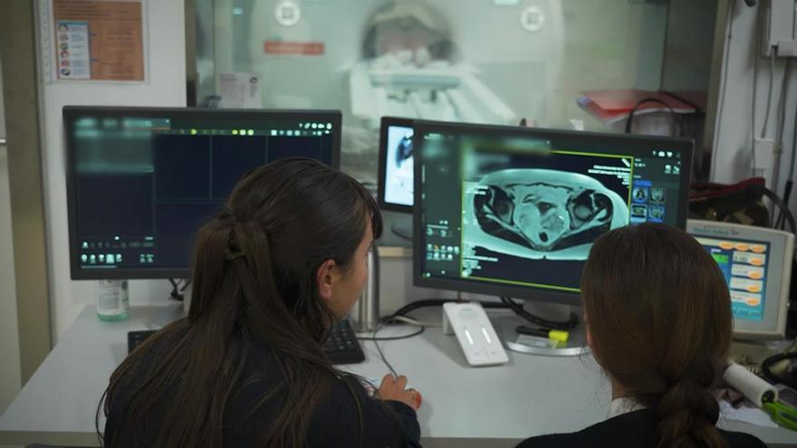 es con cáncer de recto pueden evitar la cirugía sin comprometer el control del tumor
