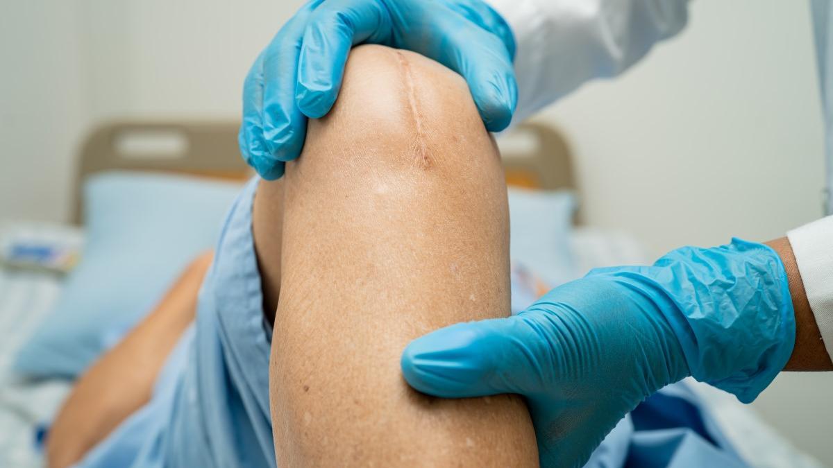 Operación de rodilla.