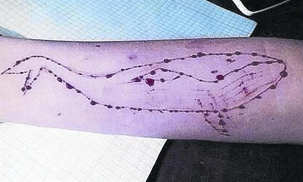 Ballena dibujada en un brazo con una cuchilla.