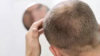 Elimina las 'áreas claras' de tu cabeza con estos polvos para rellenar el pelo que arrasan
