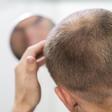 Elimina las áreas claras de tu cabeza con estos polvos para rellenar el pelo que arrasan
