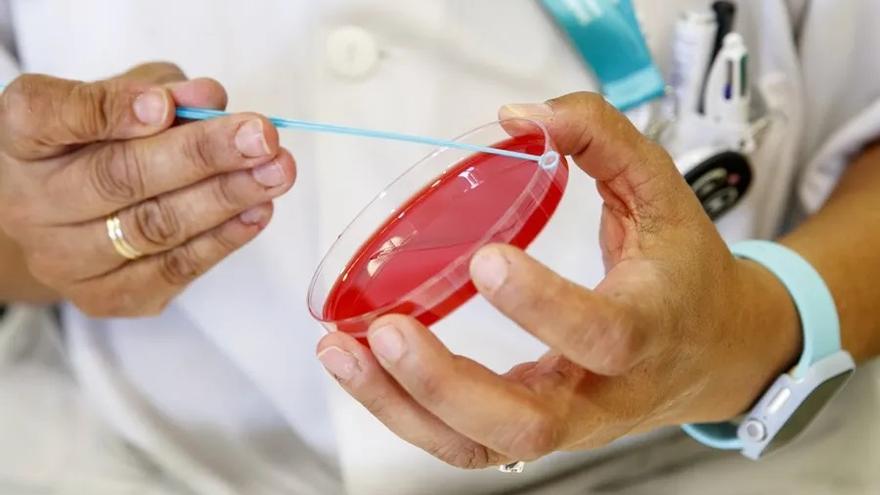 La bacteria sospechosa del brote de Córdoba (E. Coli) no es mortal, pero es necesario eliminarla