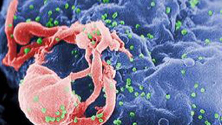 Un pacient podria tenir la clau de la vacuna del VIH