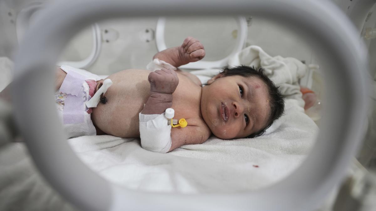 Aya, la &quot;nena miracle&quot;, ingressada en un hospital de la localitat d'Afrin, a Síria