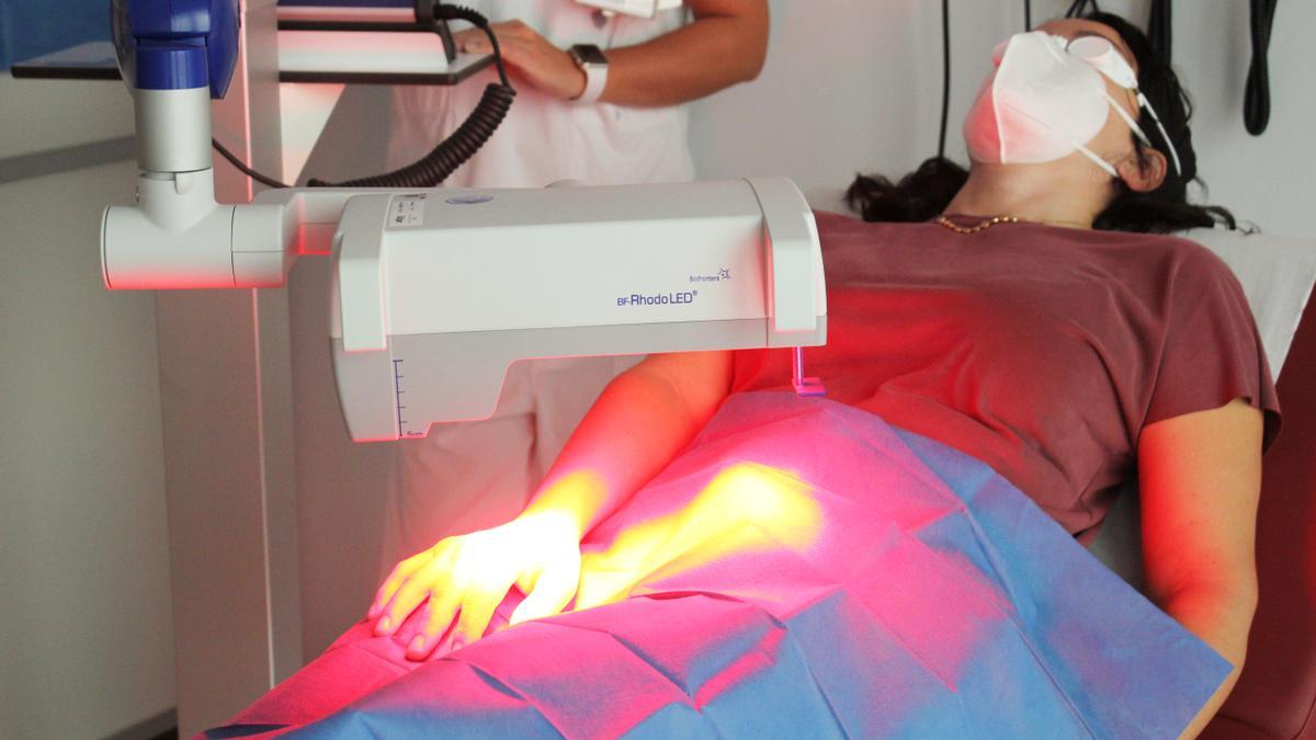 Aplicación de la terapia para prevenir tumores en la piel que ha implantado el Hospital del Vinalopó