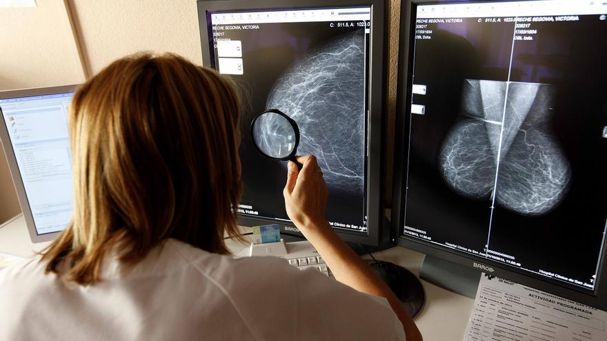 CCOO and UGT assure that the waiting list for mammograms at the Torrevieja Hospital is 6 months and Health denies it