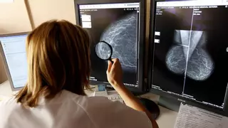 El cáncer de mama es el más frecuente en mujeres en la provincia de Alicante