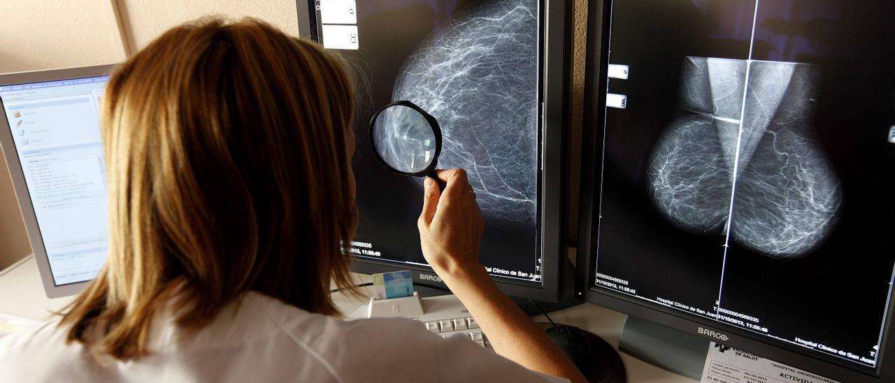 La demora en mamografías urgentes alcanza los seis meses en el Hospital Universitario de Torrevieja