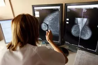 CCOO y UGT aseguran que la lista de espera para mamografías en el Hospital de Torrevieja es de 6 meses y Sanidad lo niega (febrero de 2022)