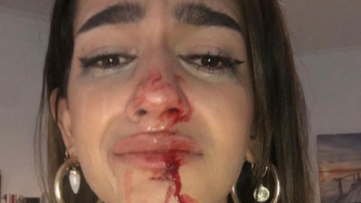 La chica de 19 años que ha denunciado en las redes que el viernes sufrió una agresión homófoba.