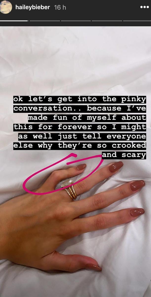 Hailey Bieber dedos torcidos