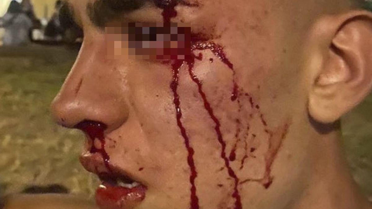 Un jove de 17 anys denuncia una agressió homòfoba a València