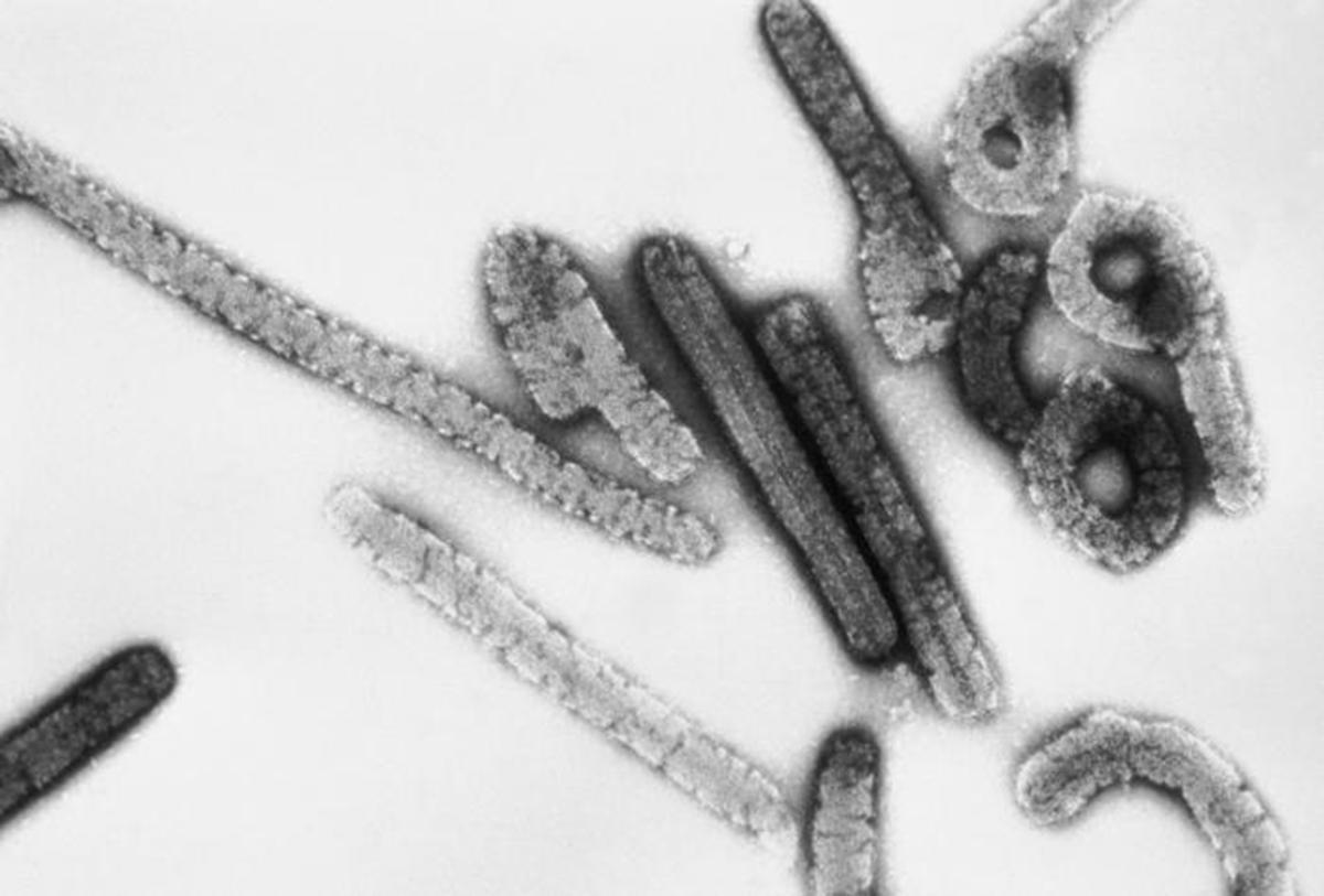 Imagen del virus de Marburgo al microscopio