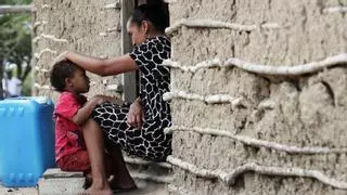 Al menos 59 niños han muerto este año por desnutrición en Colombia