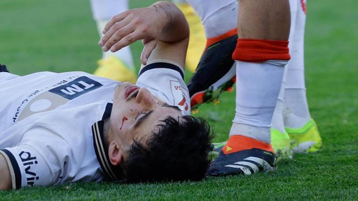 Diego López, tras caer lesionado ante el Almería