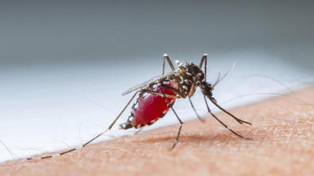 El virus zika puede provocar microcefalia en los bebés.