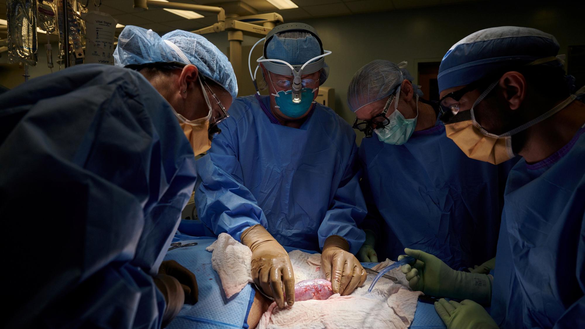 The surgical team examines the pig kidney for any signs of hyperacute rejection, as the organ was implanted outside the body to allow for observation and tissue sampling during the 54-hour study period, at NYU Langone in New York, U.S., in this undated handout photo. Joe Carrotta for NYU Handout via REUTERS NO RESALES. NO ARCHIVES. THIS IMAGE HAS BEEN SUPPLIED BY A THIRD PARTY.