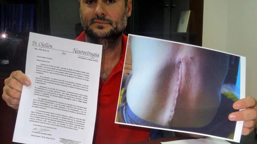 Raniero Brando muestra una foto con la cicatriz de su intervención quirúrgica.  | lp