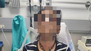 Una imagen de la víctima con encadenada, tras acudir al hospital el pasado lunes.